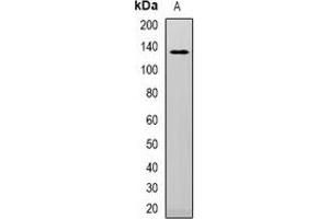 Western blot analysis of Telomerase expression in HepG2 (A) whole cell lysates. (TERT Antikörper)