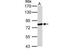 WB Image MX1 antibody [N2C2], Internal detects MX1 protein by Western blot analysis.
