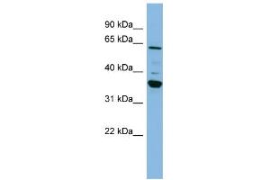 WB Suggested Anti-CYP3A7 Antibody Titration:  0. (CYP3A7 Antikörper  (Middle Region))