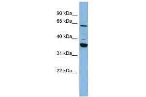Western Blotting (WB) image for anti-Cytochrome P450, Family 3, Subfamily A, Polypeptide 7 (CYP3A7) (Middle Region) antibody (ABIN2776999)