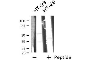 Western blot analysis GIPR  using HT-29 whole cell lysates (GIPR Antikörper  (Internal Region))
