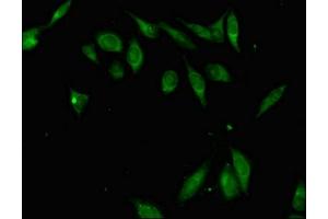 Immunofluorescent analysis of Hela cells using ABIN7176303 at dilution of 1:100 and Alexa Fluor 488-congugated AffiniPure Goat Anti-Rabbit IgG(H+L) (ZFP42 Antikörper  (AA 6-68))