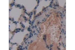 IHC-P analysis of Mouse Tissue, with DAB staining. (Surfactant Protein C Antikörper  (AA 94-193))