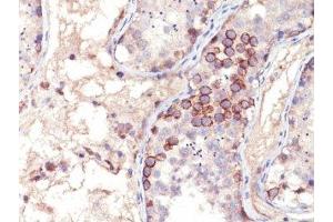 Formalin-fixed, paraffin-embedded human testis stained with MAGE-1 antibody (MA454).