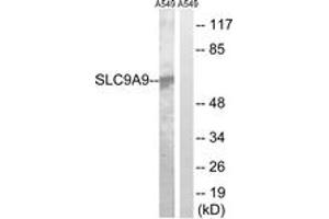 Western Blotting (WB) image for anti-Solute Carrier Family 9, Subfamily A (NHE9, Cation Proton Antiporter 9), Member 9 (SLC9A9) (AA 171-220) antibody (ABIN2890645) (SLC9A9 Antikörper  (AA 171-220))