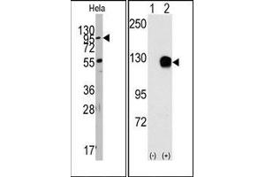 Image no. 1 for anti-TYRO3 Protein Tyrosine Kinase (TYRO3) antibody (ABIN359941) (TYRO3 Antikörper)