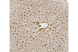 IHC analysis of Alanine Transaminase/Gpt using anti-Alanine Transaminase/Gpt antibody (ABIN7600506).