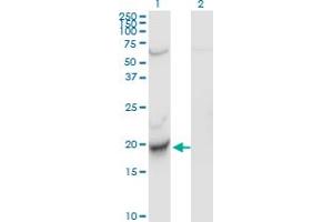 Western Blot analysis of CENPM expression in transfected 293T cell line by C22orf18 monoclonal antibody (M01), clone 4C12-2C8. (CENPM Antikörper  (AA 1-180))