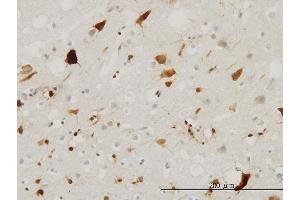Immunoperoxidase of monoclonal antibody to PTN on formalin-fixed paraffin-embedded human cerebral cortex. (Pleiotrophin Antikörper  (AA 45-154))