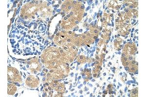 Troponin I Type 1 antibody was used for immunohistochemistry at a concentration of 4-8 ug/ml to stain Epithelial cells of renal tubule (arrows) in Human Kidney.