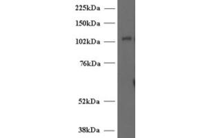 Western Blotting (WB) image for anti-Unc-13 Homolog D (UNC13D) (Internal Region) antibody (ABIN2466419) (UNC13D Antikörper  (Internal Region))