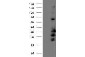 Western Blotting (WB) image for anti-Receptor Accessory Protein 2 (REEP2) antibody (ABIN1500658) (REEP2 Antikörper)