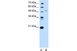 WB Suggested Anti-SPTLC1 Antibody Titration:  0. (SPTLC1 Antikörper  (Middle Region))