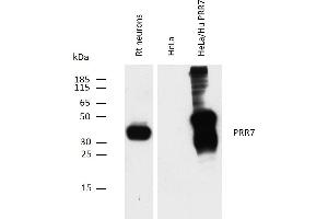 Western blotting analysis of PRR7 using mouse monoclonal antibody TRAP3/10 on rat neuron lysate, and on HeLa transfectants overexpressing human PRR7, compared with non-transfected HeLa cells (negative control). (PRR7 Antikörper  (C-Term, Intracellular))