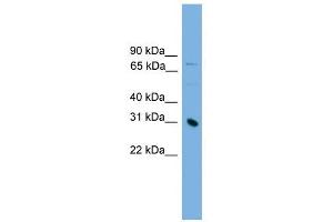 PRSS8 antibody used at 1 ug/ml to detect target protein.