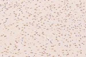 Immunohistochemistry (Paraffin-embedded Sections) (IHC (p)) image for anti-Zinc Finger Protein 154 (ZNF154) antibody (ABIN7076261)