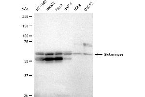 Western blotting analysis using Glutaminase antibody (ABIN7798747).