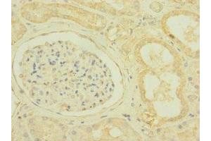Immunohistochemistry of paraffin-embedded human kidney tissue using ABIN7169925 at dilution of 1:100 (SCN7A Antikörper  (AA 265-368))