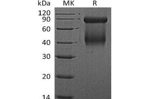 Western Blotting (WB) image for Granzyme D (GZMD) protein (His tag) (ABIN7320541) (Granzyme D Protein (GZMD) (His tag))