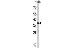 Image no. 1 for anti-Actin Related Protein 2/3 Complex, Subunit 1A, 41kDa (ARPC1A) (C-Term) antibody (ABIN452762) (ARPC1A Antikörper  (C-Term))