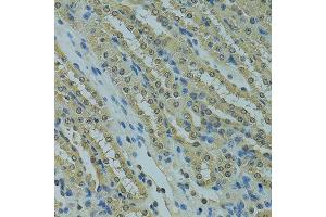 Immunohistochemistry of paraffin-embedded mouse kidney using UBE2I antibody. (UBE2I Antikörper  (AA 1-158))