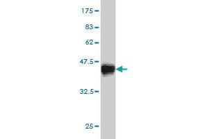 Western Blot detection against Immunogen (35. (CDK8 Antikörper  (AA 375-464))