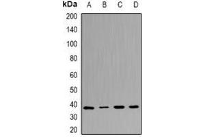 Western blot analysis of UFD1L expression in Jurkat (A), A431 (B), mouse heart (C), rat brain (D) whole cell lysates.