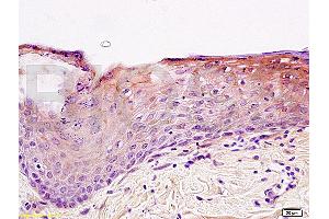 Formalin-fixed and paraffin embedded rat skin tissue labeled with Anti-Integrin beta 1/CD29 Polyclonal Antibody (ABIN669216), Unconjugated at 1:200, followed by conjugation to the secondary antibody and DAB staining (ITGB1 Antikörper  (AA 25-100))