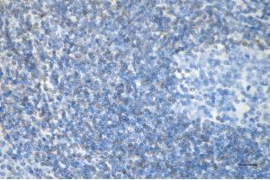 Immunohistochemistry was performed on paraffin-embedded human tonsillitis using bcl-2 antibody (ABIN7797719), 1:200). (Rekombinanter Bcl-2 Antikörper)