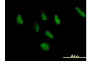 Immunofluorescence of purified MaxPab antibody to ZNF346 on HeLa cell.