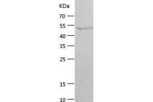 Western Blotting (WB) image for Sirtuin 4 (SIRT4) (AA 1-314) protein (His-IF2DI Tag) (ABIN7289592) (SIRT4 Protein (AA 1-314) (His-IF2DI Tag))