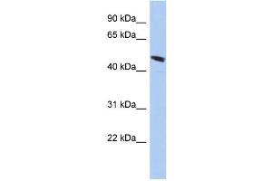 WB Suggested Anti-C9orf68 Antibody Titration: 0. (C9orf68 Antikörper  (Middle Region))