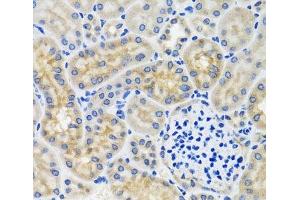 Immunohistochemistry of paraffin-embedded Mouse kidney using ANTXR2 Polyclonal Antibody at dilution of 1:100 (40x lens). (ANTXR2 Antikörper)