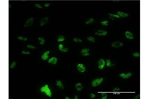Immunofluorescence of monoclonal antibody to PUF60 on HeLa cell. (PUF60 Antikörper  (AA 1-516))