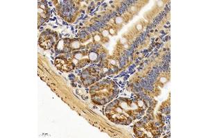 Immunohistochemistry of paraffin embedded mouse duodenum using TAF4 (ABIN7075827) at dilution of 1:450 (400x lens) (TAF4 Antikörper)