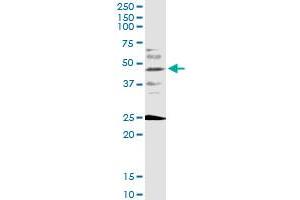 FOXF2 monoclonal antibody (M08), clone 3D11. (FOXF2 Antikörper  (AA 346-443))