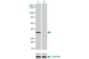 Western blot analysis of STK16 over-expressed 293 cell line, cotransfected with STK16 Validated Chimera RNAi (Lane 2) or non-transfected control (Lane 1).