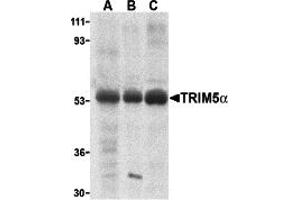 Western Blotting (WB) image for anti-Tripartite Motif Containing 5 (TRIM5) (Middle Region 1) antibody (ABIN1031194) (TRIM5 Antikörper  (Middle Region 1))