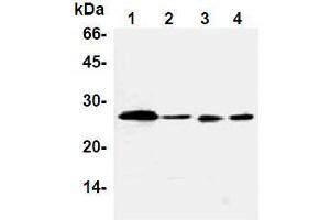 Western Blotting (WB) image for anti-B-Cell CLL/lymphoma 2 (BCL2) antibody (ABIN1105506) (Bcl-2 Antikörper)