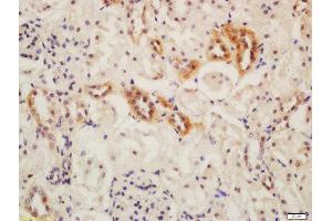 Formalin-fixed and paraffin embedded mouse kidney labeled with Rabbit Anti-ATG13 Polyclonal Antibody, Unconjugated  at 1:200 followed by conjugation to the secondary antibody and DAB staining (ATG13 Antikörper  (AA 51-150))
