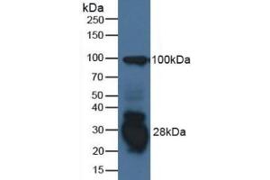 Detection of IFI30 in Human Raji Cells using Polyclonal Antibody to Interferon Gamma Inducible Protein 30 (IFI30) (IFI30 Antikörper  (AA 1-250))