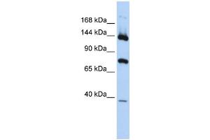 WB Suggested Anti-PLA2G4B Antibody Titration:  0.