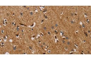 Immunohistochemistry of paraffin-embedded Human brain tissue using IL18R1 Polyclonal Antibody at dilution 1:40 (IL18R1 Antikörper)