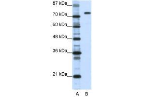 Nucleolin antibody used at 1. (Nucleolin Antikörper  (C-Term))