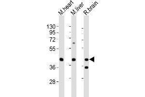 Western Blotting (WB) image for anti-Pyrimidinergic Receptor P2Y, G-Protein Coupled, 4 (P2RY4) (AA 5-42), (N-Term) antibody (ABIN6243932)