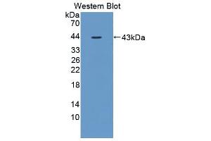Western blot analysis of the recombinant protein. (IL12B Antikörper  (AA 30-311))