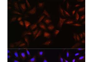 Immunofluorescence analysis of U-2 OS cells using BTRC Polyclonal Antibody at dilution of 1:100. (BTRC Antikörper)