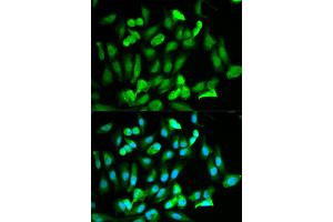 Immunofluorescence analysis of HeLa cells using ERG antibody (ABIN5970582). (ERG Antikörper)