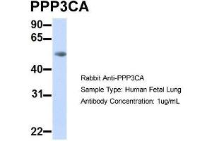 Host:  Rabbit  Target Name:  PPP3CA  Sample Type:  Human Fetal Lung  Antibody Dilution:  1. (PPP3CA Antikörper  (Middle Region))