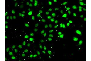 Immunofluorescence analysis of HeLa cells using NUDT2 antibody. (NUDT2 Antikörper)